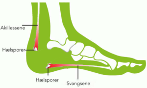https://www.reporto.dk/wp-content/uploads/2023/06/haelsporer-300x179.png